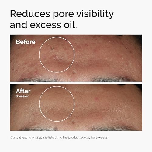 The Ordinary Niacinamide 10% + Zinc 1%, Sérum illuminant et lissant, pour les peaux sujettes aux imperfections, 30 ml (Lot de 2) Amazon.fr: Autres – Image 2