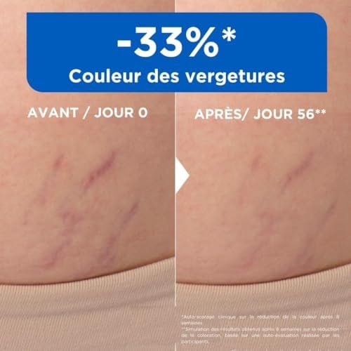 Mixa Huile Anti-Vergetures 100ml avec 30% Omégas 6 & 9 – Image 3